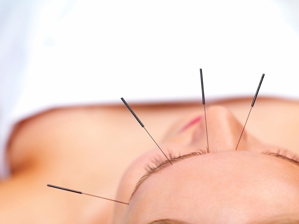 acupuntura-img